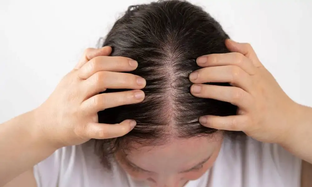 بالصور زراعة الشعر للنساء