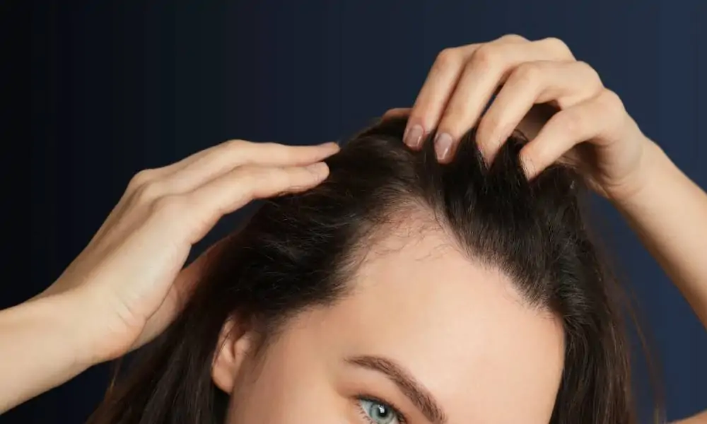 طريقة زراعة الشعر للنساء