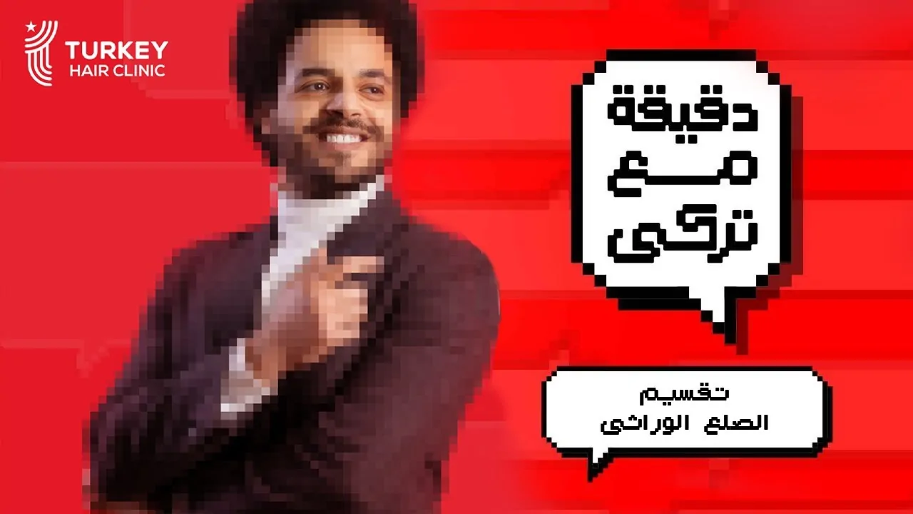 7 درجات للصلع الوراثي تعرف عليهم