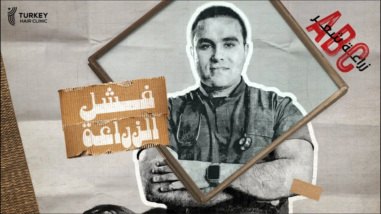 أسباب فشل عملية زراعة الشعر