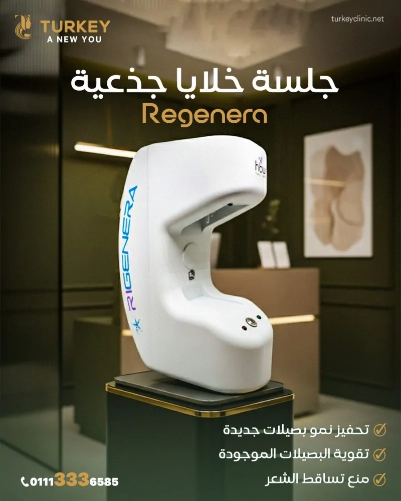 افضل طرق زراعة الشعر لعام 2025 | تجارب ونتائج بالصور 3 زراعة الشعر بتقنية الريجينيرا Regenera