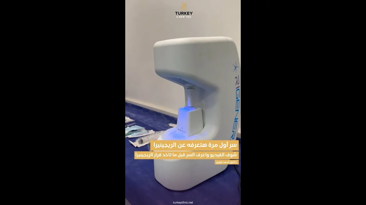 أسرار تقنية الريجينيرا لأول مرة
