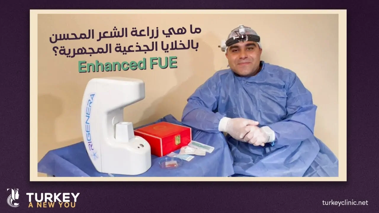 زراعة الشعر المحسن باستخدام تقنية الريجينيرا