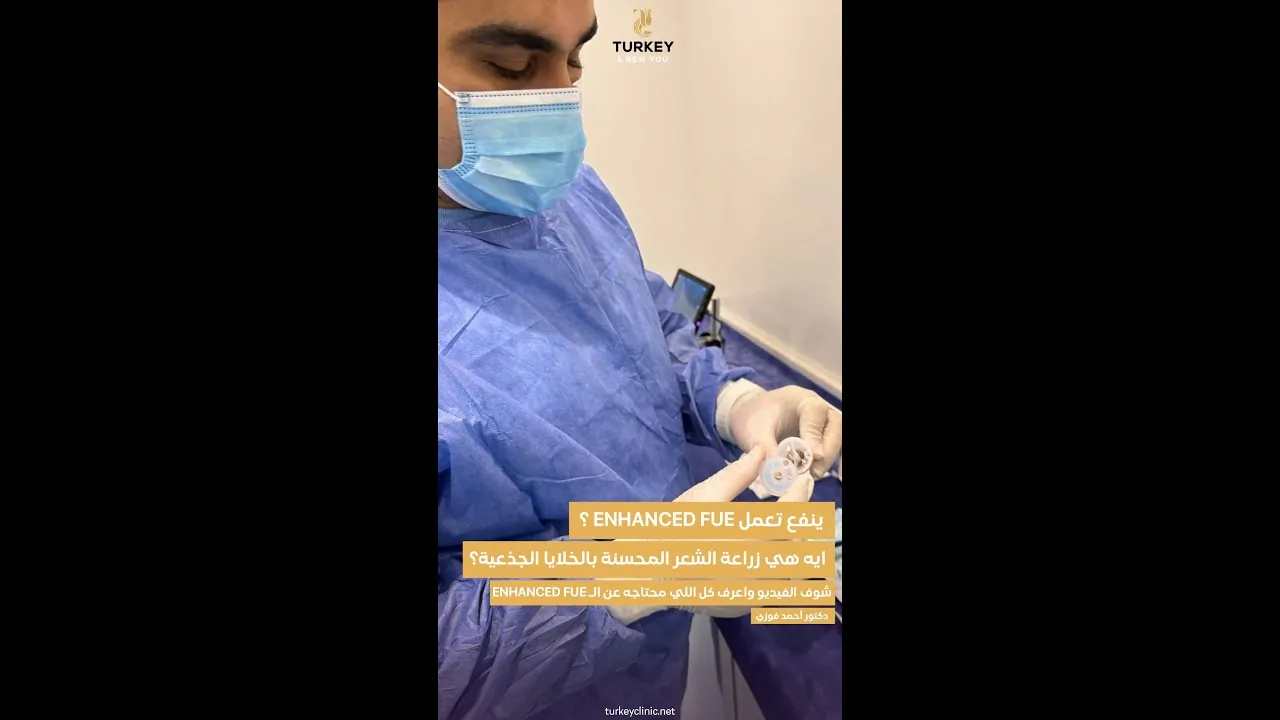 زراعة الشعر المحسن بالخلايا الجذعية