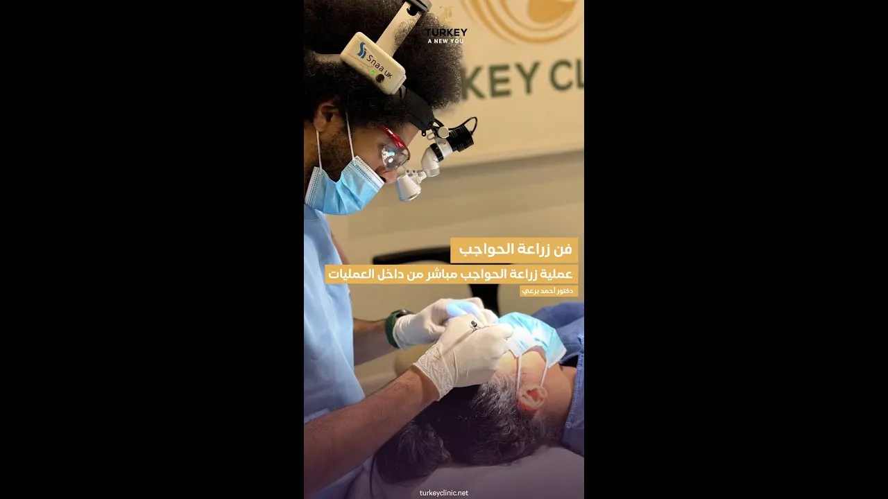 زراعة شعر الحواجب في مصر