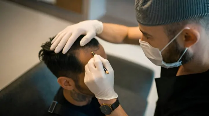 زراعة شعر مقدمة الرأس للرجال 1