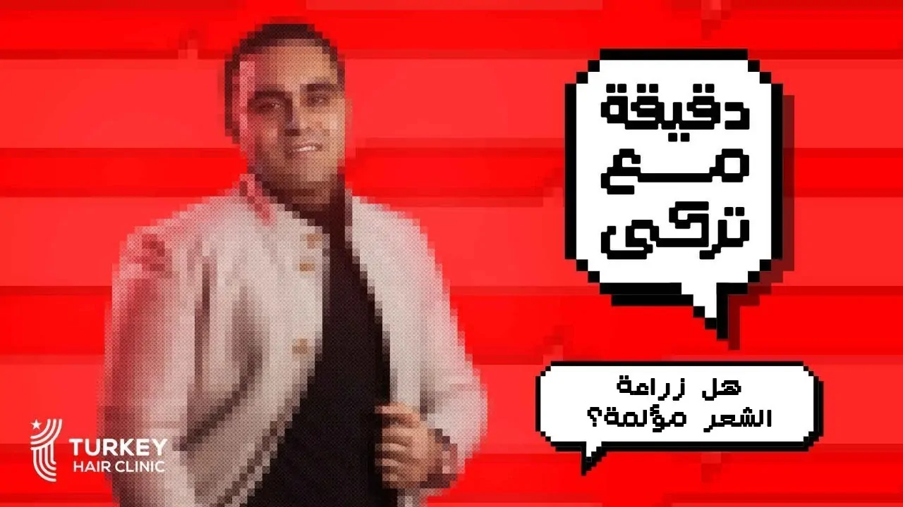 هل زراعة الشعر مؤلمة؟ د. احمد فوزي