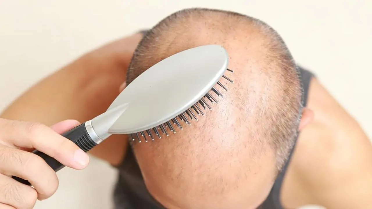 تدليك الرأس بعد زراعة الشعر