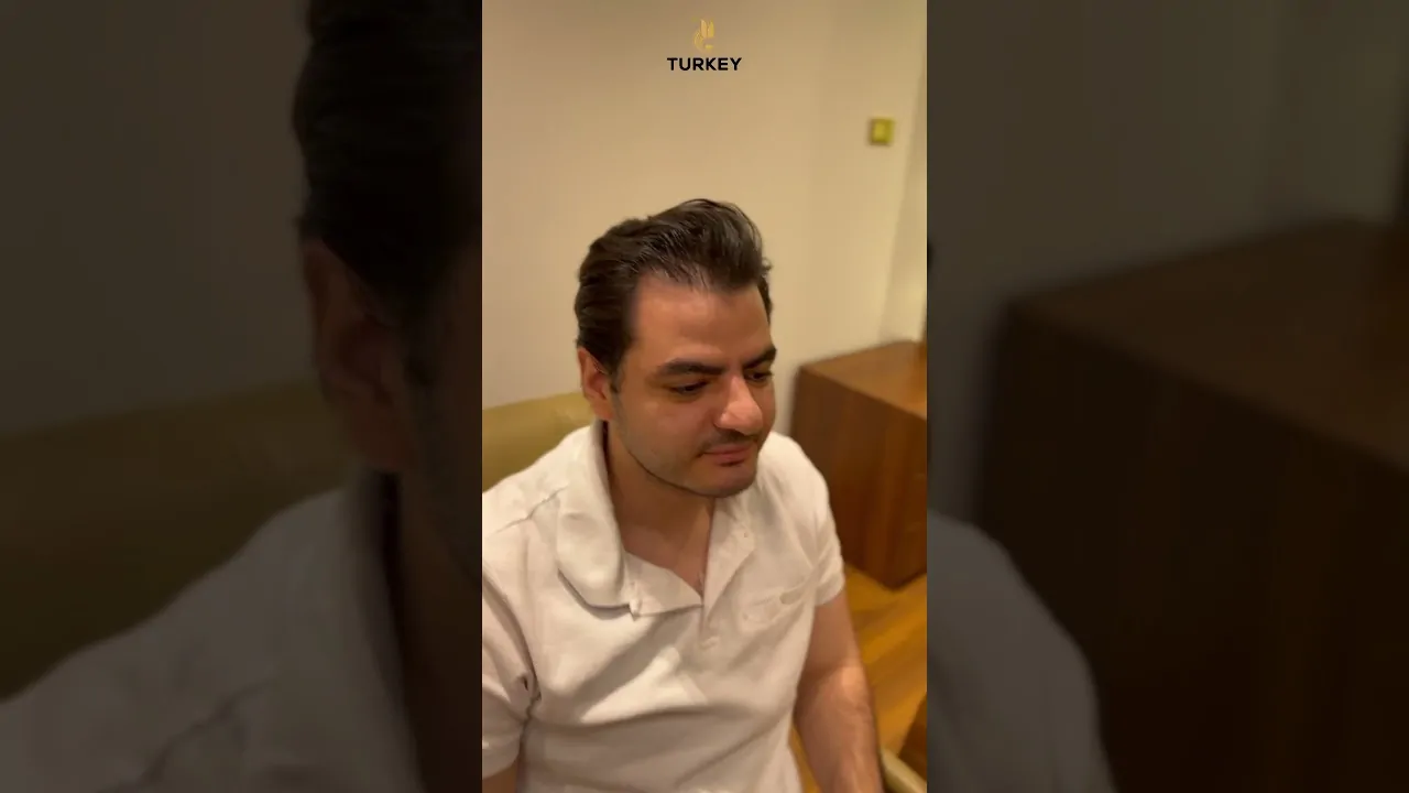 نتيجة بعد زراعة شعر لصلع من الدرجة الرابعة