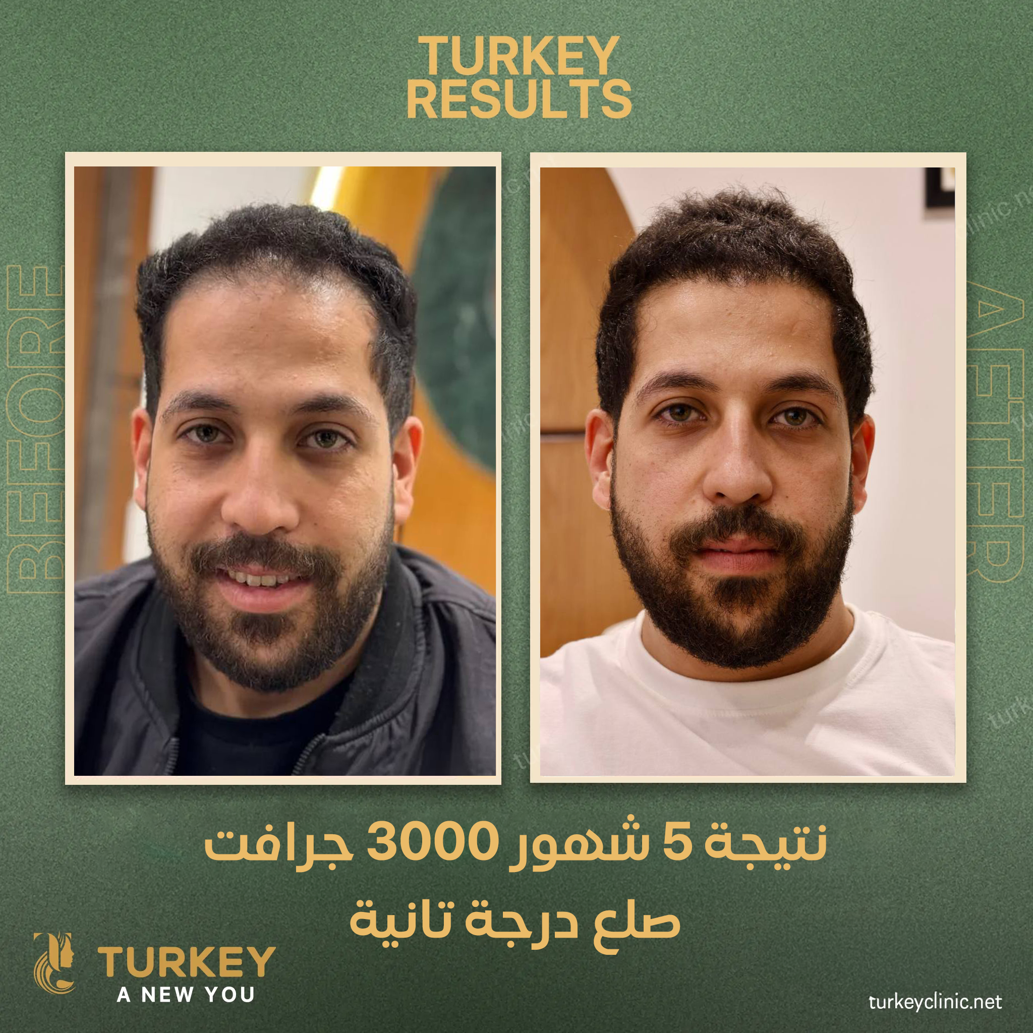 نتيجة زراعة 3000 جرافت بعد 5 شهور من الزراعة