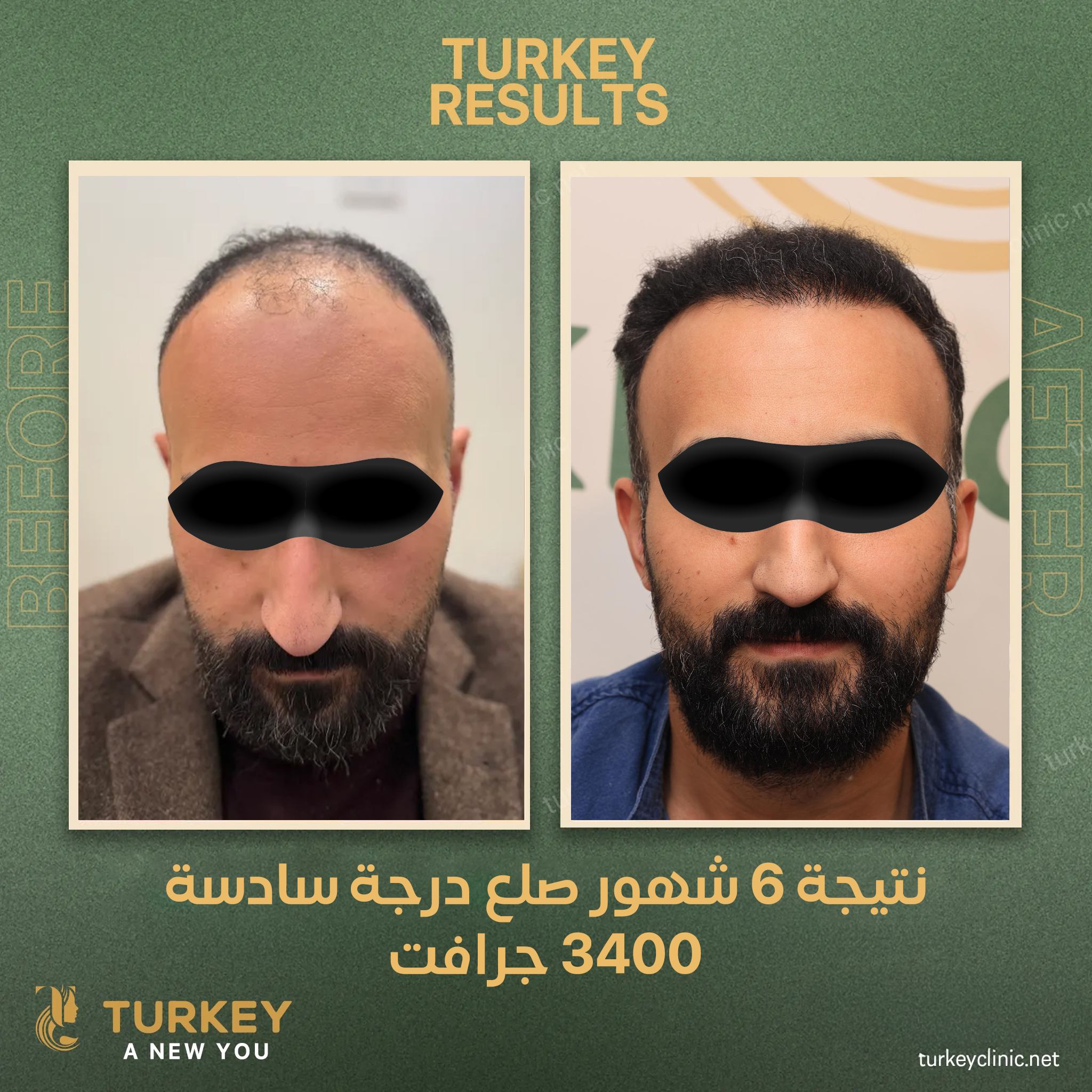 نتيجة زراعة 3400 جرافت بعد 6 شهور