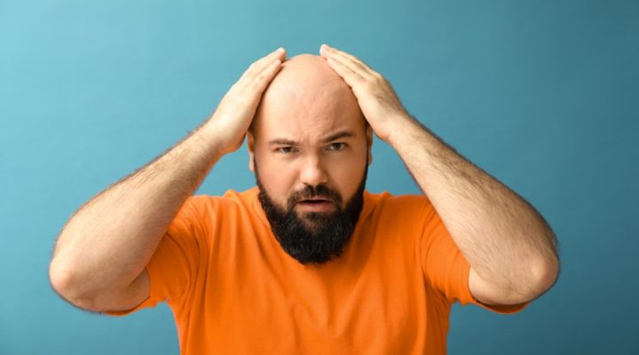 زراعة 4000 بصيلة