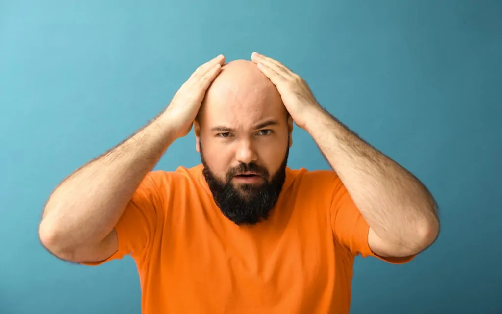 هل يمكن زراعة 4000 بصيلة؟ تعرف على آراء الأطباء بتركي كلينك 17 زراعة 4000 بصيلة