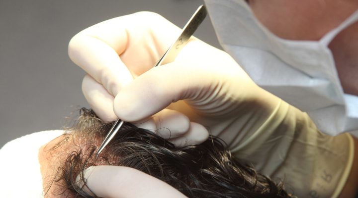 سعر عملية تصغير الجبهة