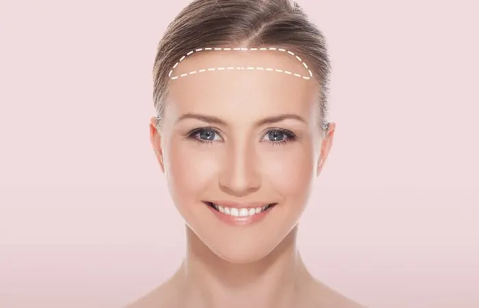 طرق تصغير الجبهة وأهم التعليمات حول النصائح بعد العملية 1 طرق تصغير الجبهة