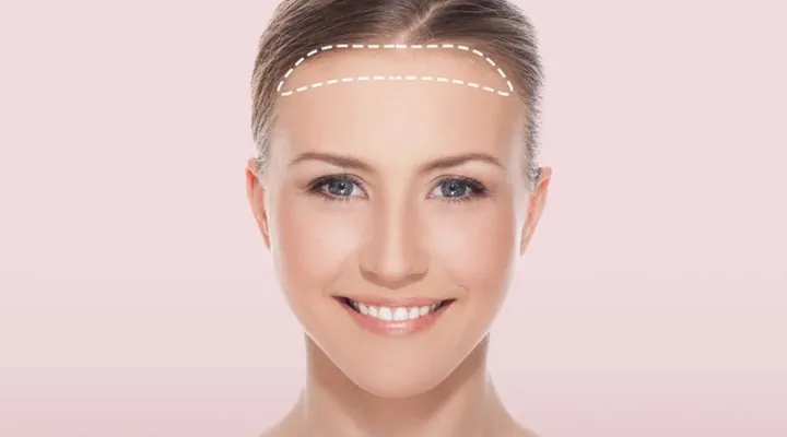 طرق تصغير الجبهة