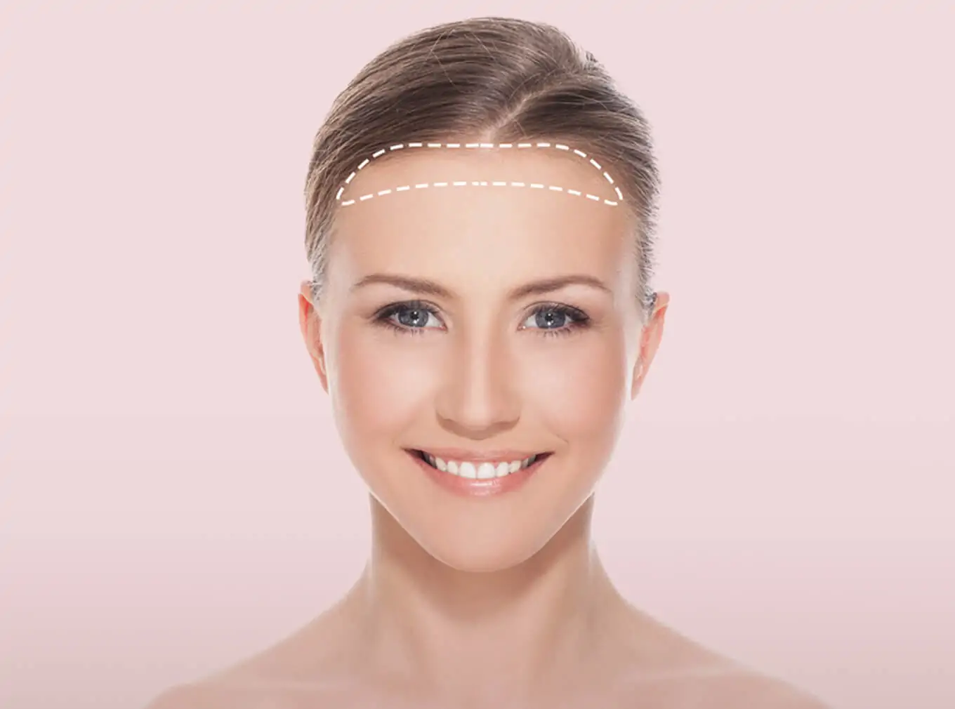 طرق تصغير الجبهة