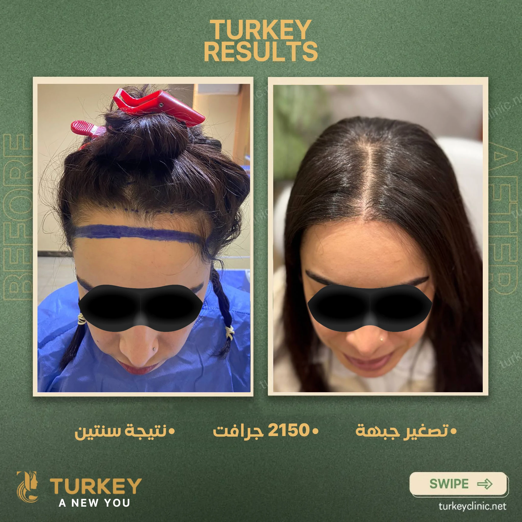 تصغير جبهة 2150 جرافت نتيجة سنتين