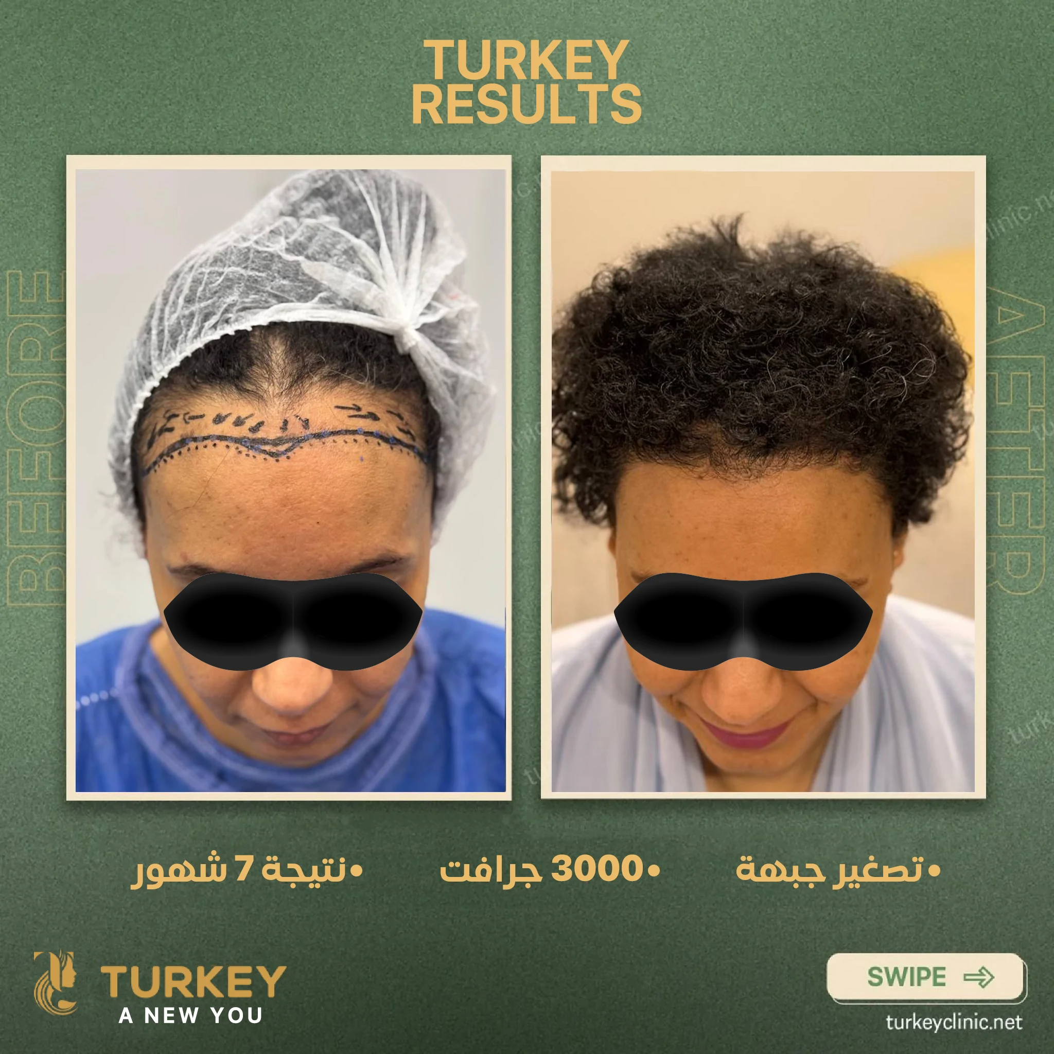 تصغير جبهة 3000 جرافت نتيجة 7 شهور