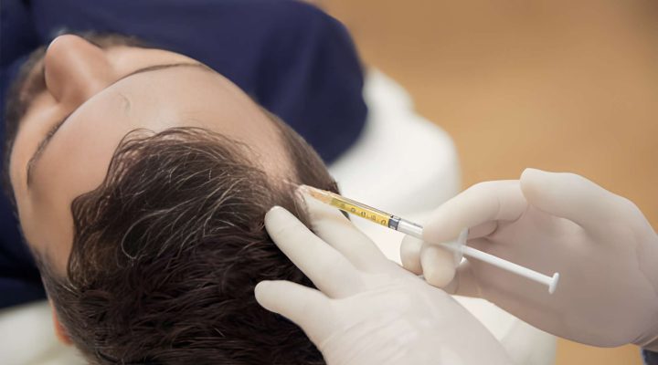 أفضل مراكز حقن البلازما في مصر