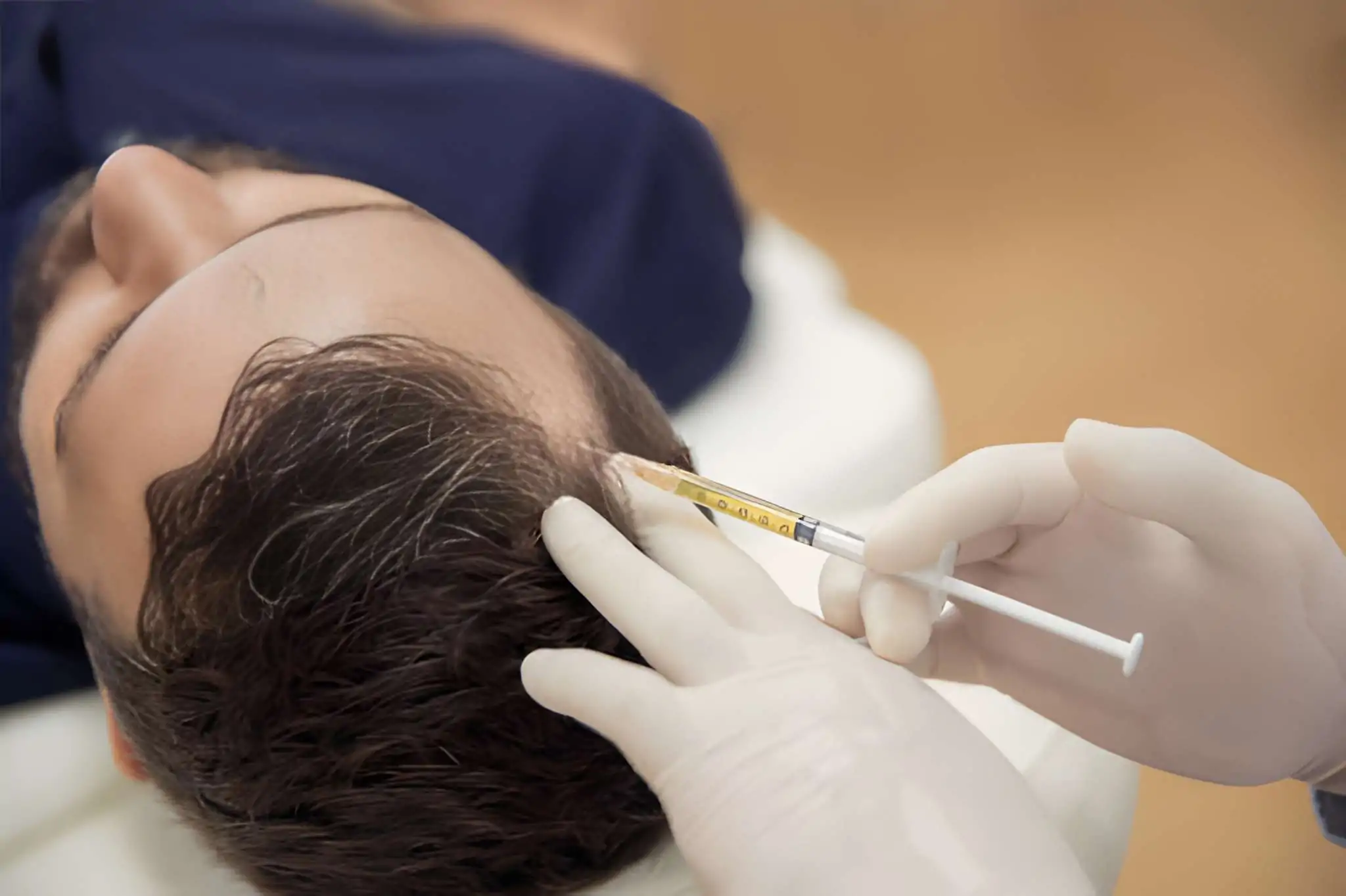 أفضل مراكز حقن البلازما في مصر