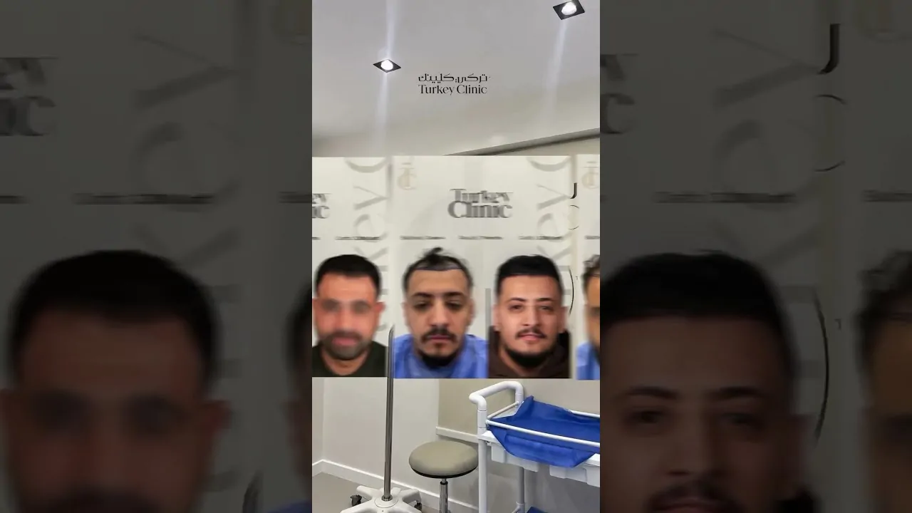 النتيجة الطبيعية في زراعة الشعر