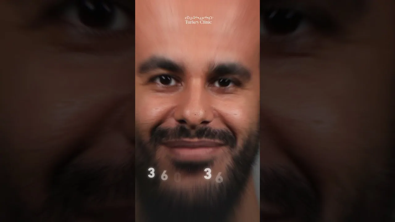 سر تصميم خط الشعر