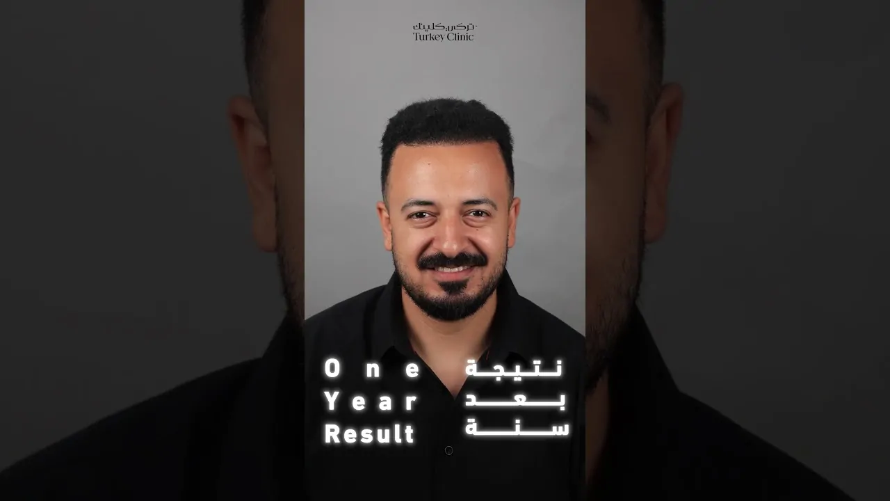علاج الصلع الوراثي من الدرجة الرابعة
