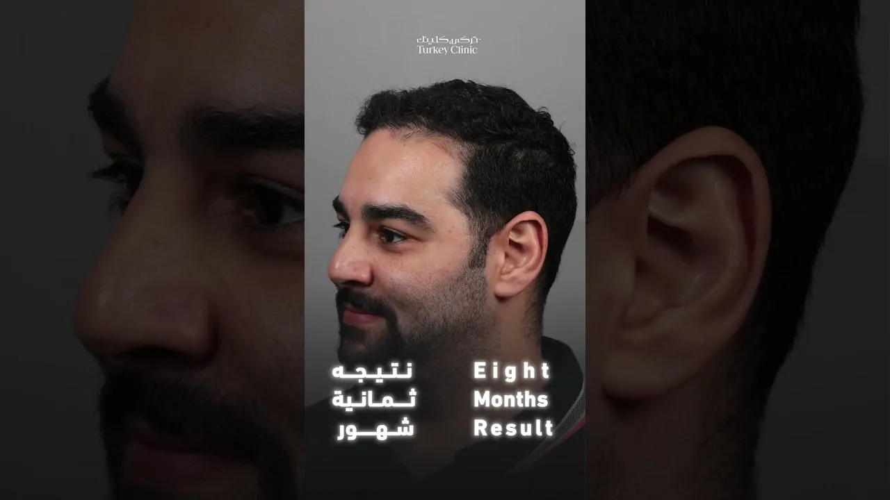 نتائج زراعة 3250 جرافت بعد 8 شهور