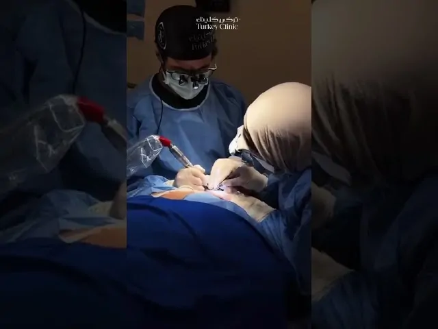 نتيجة زراعة الشعر الطبيعية
